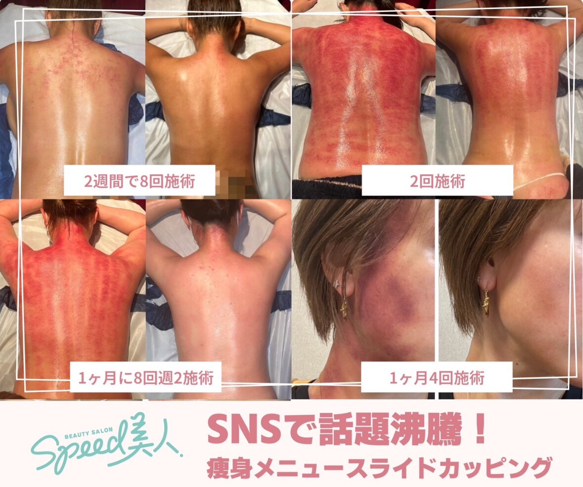 ☆☆痩身で根強い人気のハイパーナイフ☆☆ 痩身で根強い人気のハイパーナイフ 20221001192502.jpg