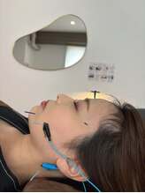 ハリファ鍼灸院 熊本院(HariFa鍼灸院)/美容鍼