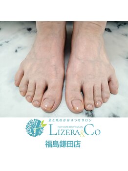 リゼランアンドコー 福島鎌田店(LIZERA&Co)/素足美人はトータルフットキュア