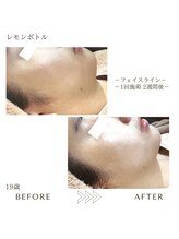 サロンエイトミー 西船橋店(salon 83)/レモンボトル/before→after