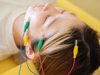 ゆめたか接骨院 鍼灸院 整体院 大沢野院/美容鍼と電気刺激で内側ケア◎