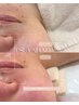【艶肌WAXリピNo.1】直後から艶々むきたまごの手触り♪ベーシックコース