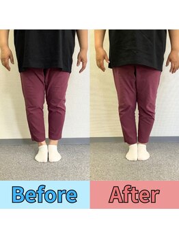 ほずみ整体院/Ｏ脚の施術