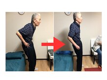 勝田台駅前整骨院/施術ビフォアアフター