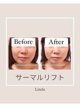 リンダ 西宮店(LINDA)/サーマルリフト