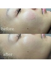 エメリーヌ(AIMELINE)/クリスティーナ　アンストレス