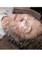 あいこ鍼灸院/300本美容鍼