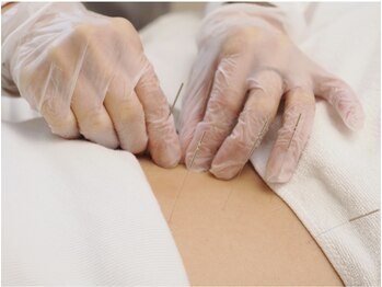 すがはら鍼灸院/お腹の不調、腰肩、手足目の疲れ