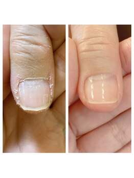 レイ(Rei)/ひどい乾燥も変われます!