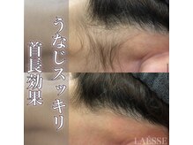 ラエッセ(LAESSE)/うなじすっきり♪