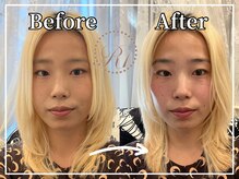 R-1ビューティーサロン 銀座/Before＆After