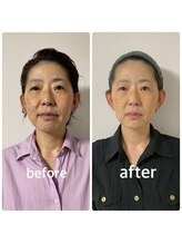 グッドライフペイ(Good Life Pay)/小顔フェイシャルの効果