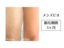 メンズビオ 神戸三宮店/