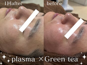 グランクウォーレ(Gran Cuore)/緑茶×プラズマシャワー◎