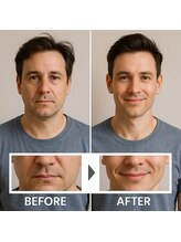 アプロ(Aphro)/若見えメンズフェイス