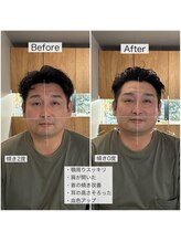 シャウルデッサン(CHARLESDESSIN)/骨格補正スパ