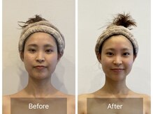 アントミョンス(Ant Myons)の雰囲気（【本格コルギ】芯をつく骨気の技で若々しい小顔へ）