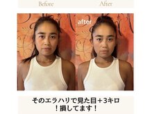 ソルズ(sol'z)の雰囲気(小顔矯正/エラ剥がし/食いしばり/たるみ)