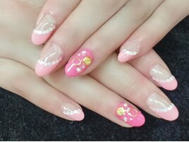 斜めフレンチ、シェルパーツ