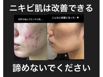 ウィズサロントータルビューティー(with salon)の写真