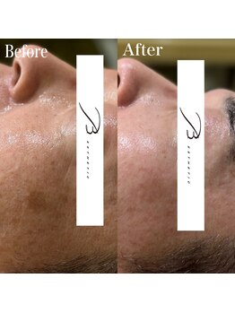 ビー エステティック(B ESTETIC)/