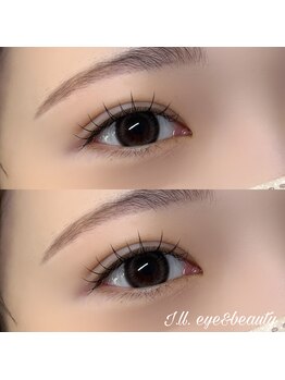 アイル(I'll)/フラットラッシュ