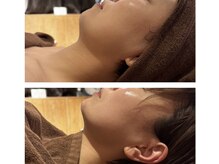 ナッティ(natti)の雰囲気（1度の施術で変化を望めます！！）