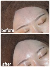 ウララ(ulala)/セラピール1回目