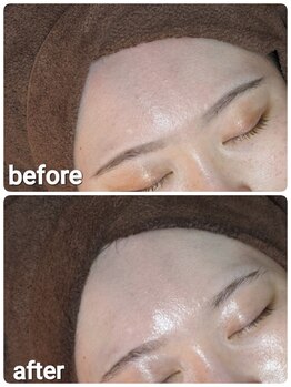 ウララ(ulala)/セラピール1回目