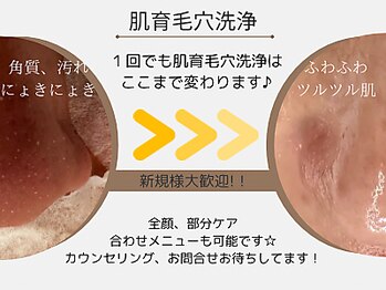 エムエー(MA)/肌育毛穴洗浄