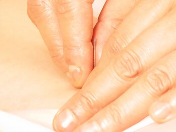 北京堂鍼灸 だんらん 静岡の写真/北京堂浅野式鍼インナーマッスル（深層筋）に鍼を届かせ大腰筋刺鍼、股関節、肩、脚などにアプローチ!