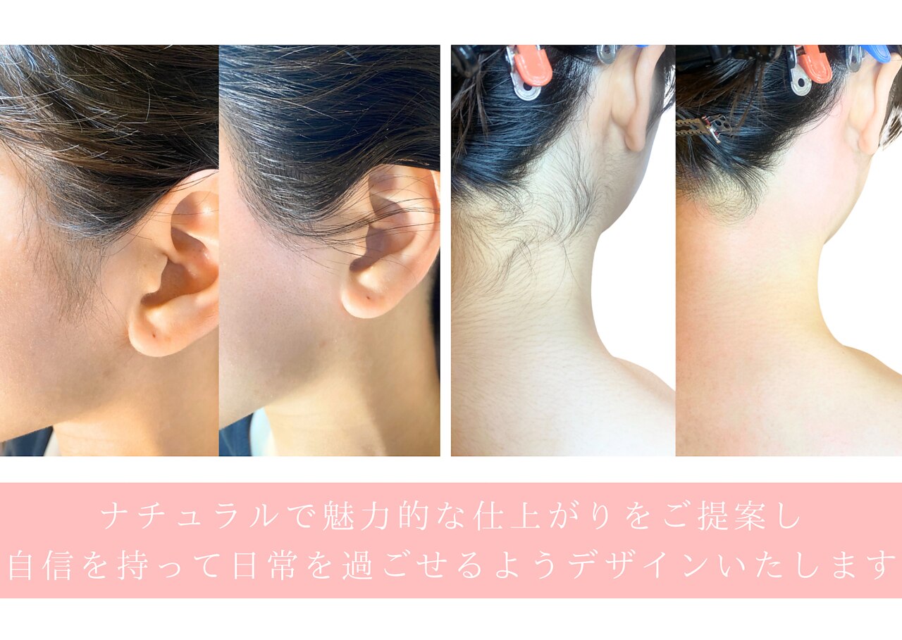 九条駅で光フェイシャルが人気のエステサロン｜ホットペッパービューティー