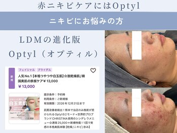 パリスヒロトン(PARIS HIROTON)/オプティル白玉