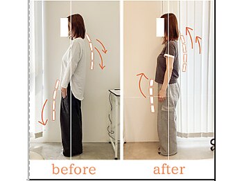 整体院ひなた 宮崎院/産後の肩こり腰痛猫背改善！