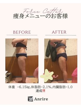 アンリール 旭川店(Anrire)/BODY施術のお客様です！