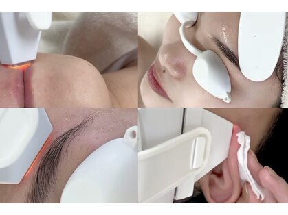 ビアンカ(BIANCA)の写真