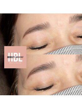 ノルジャ(NOLZA)/【HBL】ハリウッドブロウリフト