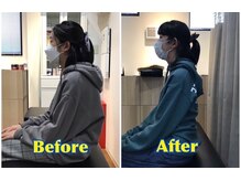 くすの樹接骨院/整体院 鳥栖院/整体/骨盤矯正ビフォーアフター