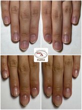 ネイルカフェ ナナ(nailcafe'nana)/自爪育成