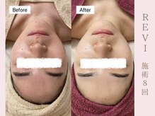 ルア(LuA.)/キメ整い肌♪