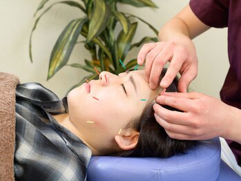 おはな整骨院 茅ヶ崎/むくみ・お肌のケアに【美容鍼】