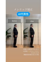 フェムーン(FEMOON)/【男性限定】メンテック矯正