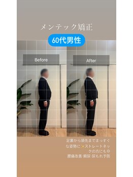 フェムーン(FEMOON)/【男性限定】メンテック矯正