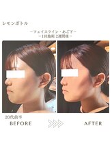 サロンエイトミー 西船橋店(salon 83)/レモンボトル/before→after