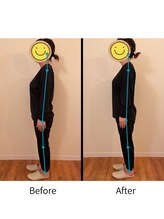 氣生/1回の施術で効果を実感/姿勢改善