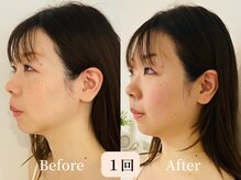 ロシュニ/30代 お悩み:歪み/偏頭痛/肩こり