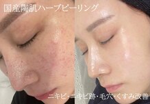 エムラボ 池袋店(M LABO)