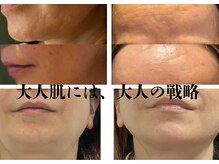 ビューティータワー(Beauty Tower)