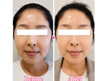 サロン ド ラジュニール(Salon de Rajeunir)/ハイパーナイフ×ハーブ♪