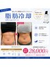 【人気No.1】期間限定☆お腹まるごと脂肪冷却♪4カップ通常¥55000→¥28000